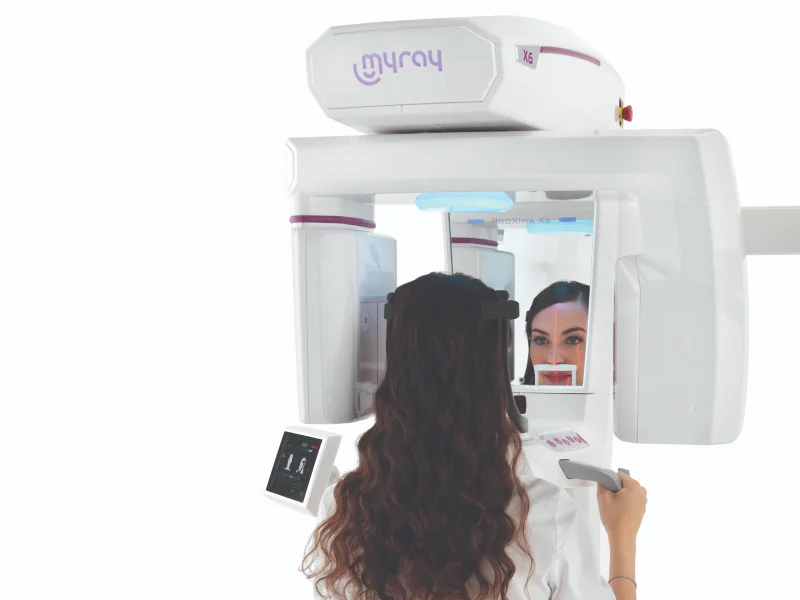 MyRay Proxima X6 06