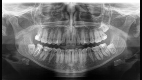 Orthophos_obsah_06