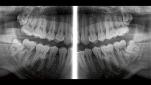 Orthophos_obsah_09