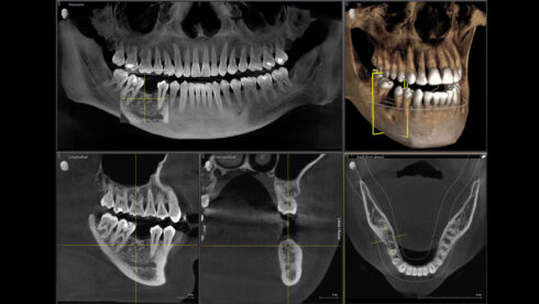 Orthophos_obsah_10