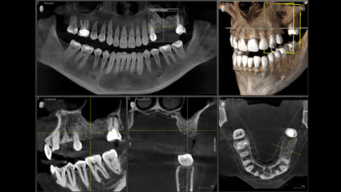 Orthophos_obsah_11