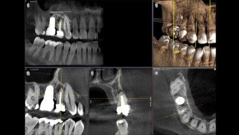 Orthophos_obsah_12