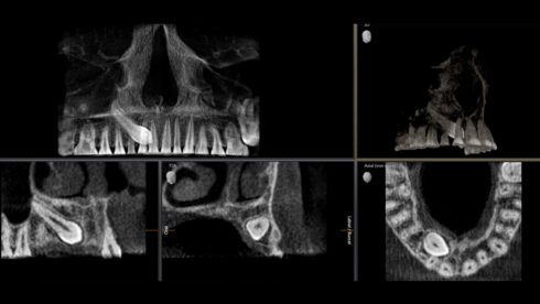 Orthophos_obsah_13